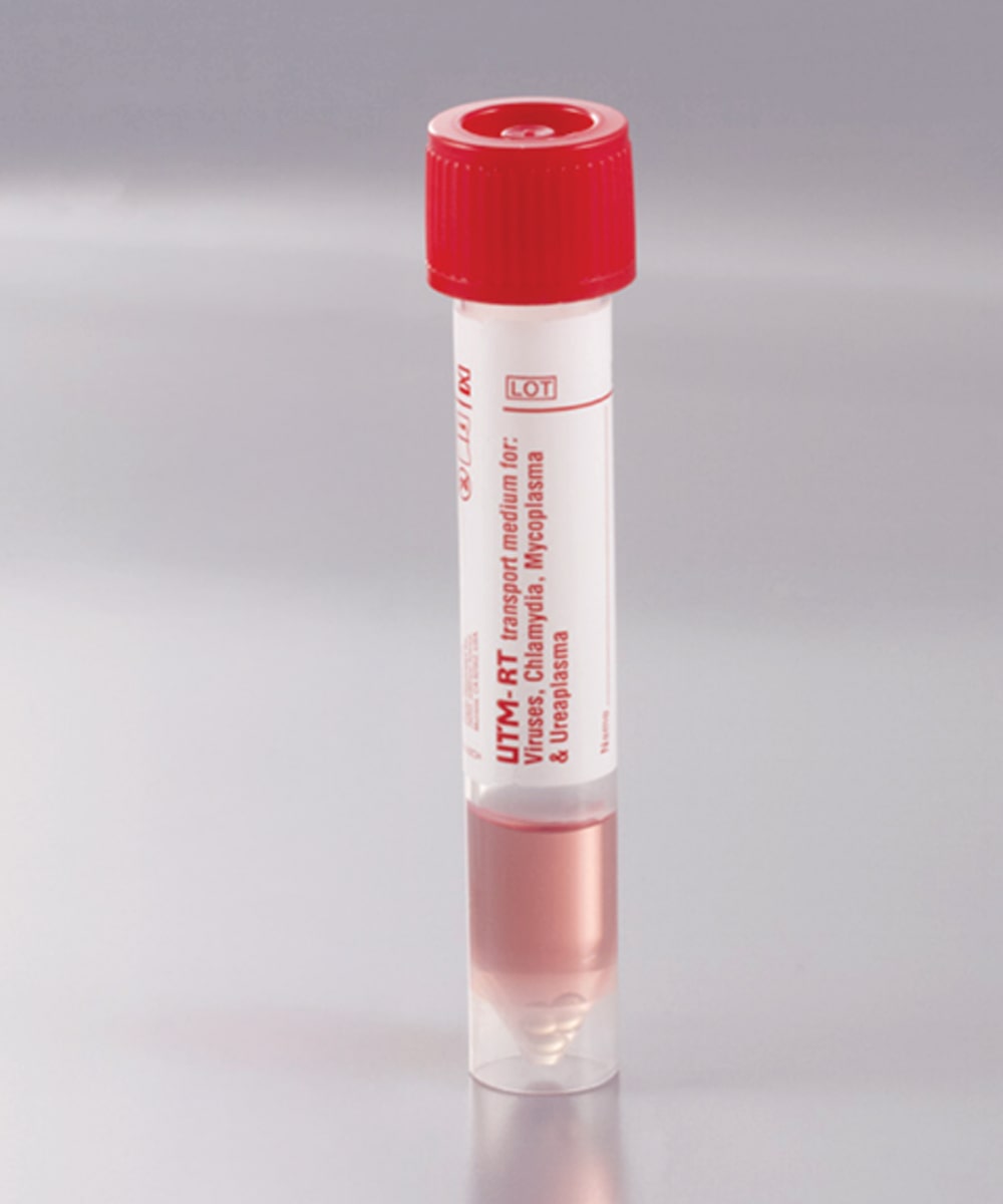 Provetta UTM da 3 mL con tappo rosso per trasporto di virus respiratori, utilizzato in laboratori per conservazione e analisi diagnostica.