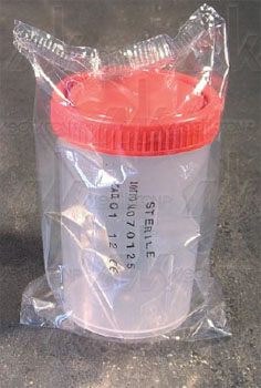 Contenitore urina sterile c/tappo a vite - ml.200 graduato fino a 175 ml 