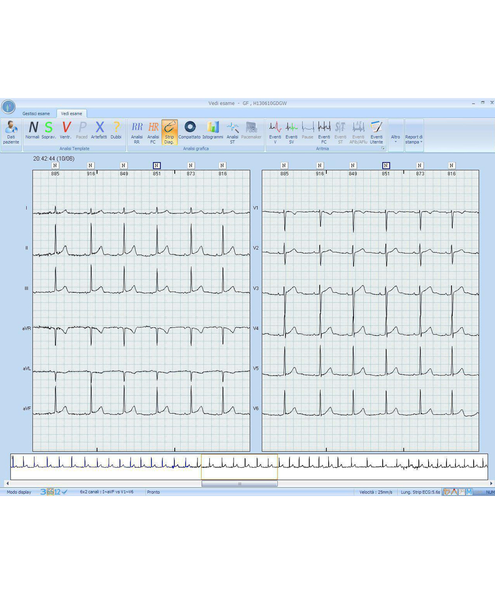 Software per Holter ECG EuroHolter SW3/12 Professional, con analisi automatica, supporto a 3, 5, 12 derivazioni e report clinici completi.