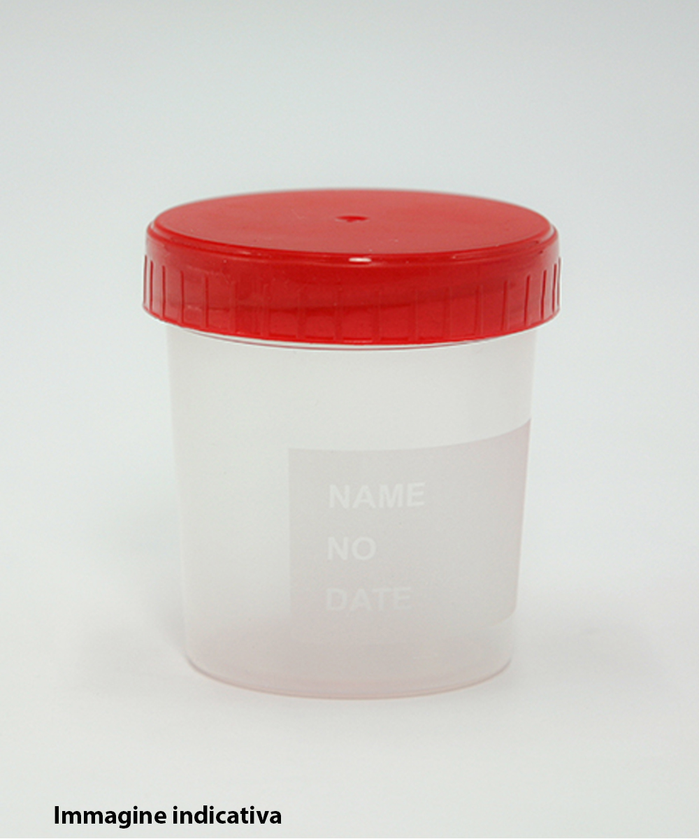 Contenitore per raccolta liquidi biologici, in particolare urina, con capacità di 120 ml e tappo a vite. Ideale per analisi chimiche e microbiologiche in laboratori biomedici.