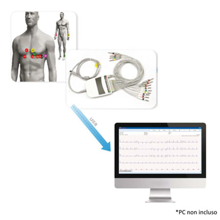 Ecg biocare interpretativo a 12 canali su base pc 