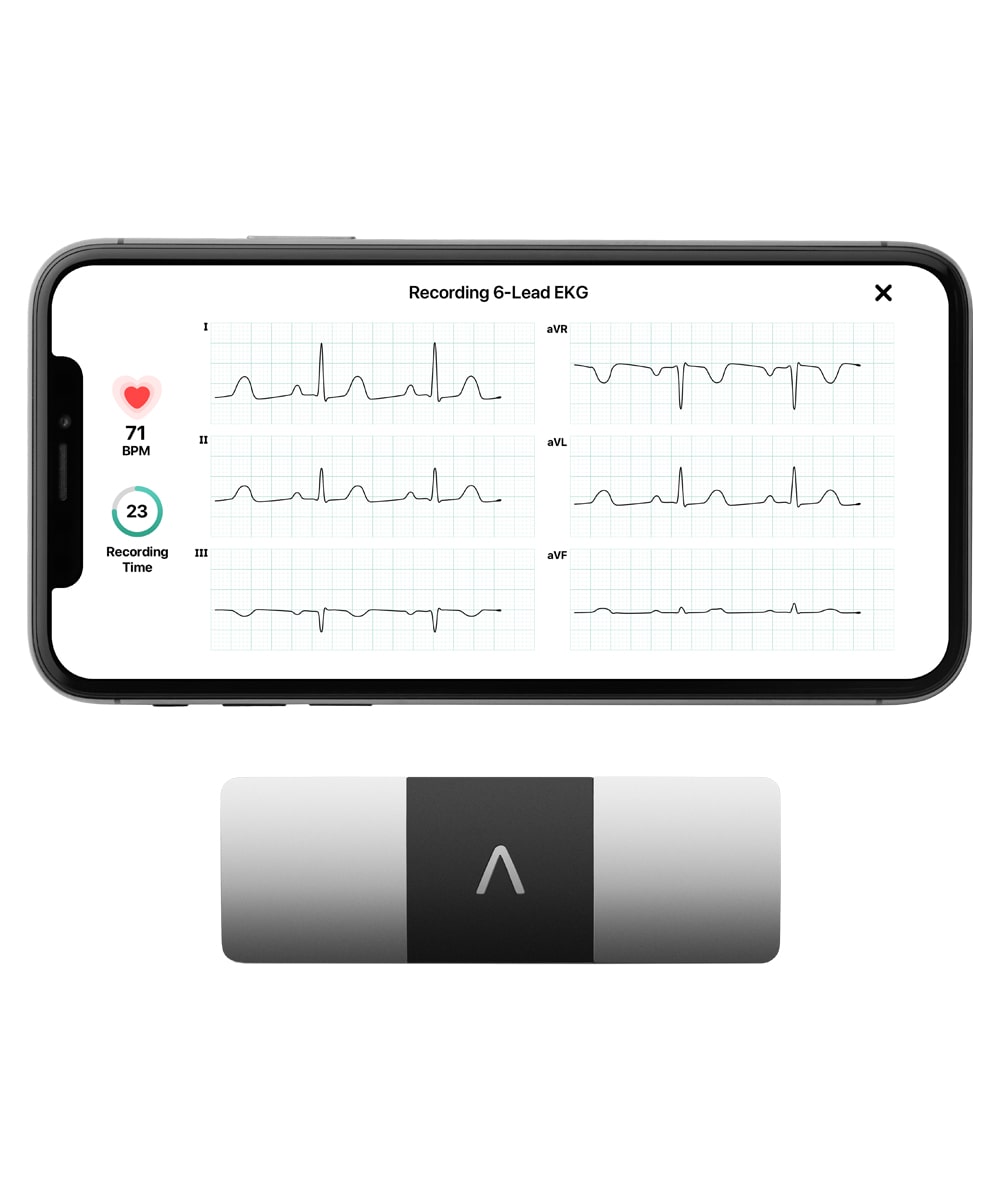 ECG Portatile Omron Kardia Mobile 6L posizionato su uno sfondo neutro, evidenziando la sua compattezza e facilità d'uso