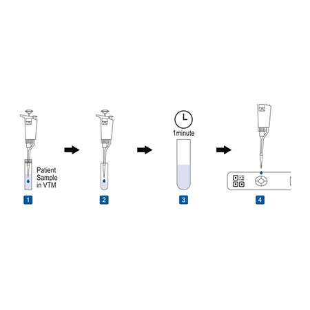 2019-ncov antigene test kit (immunofluorescenza) quantitativo cf 25 pz 