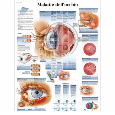 Tavola anatomica le malattie dell'occhio, mis. cm. 50x67 