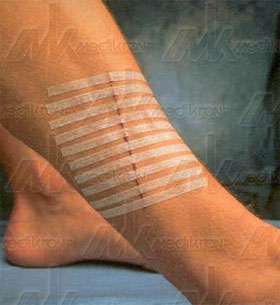 Steri-strip mm. 25x125 3m bust. da 4 strisce 