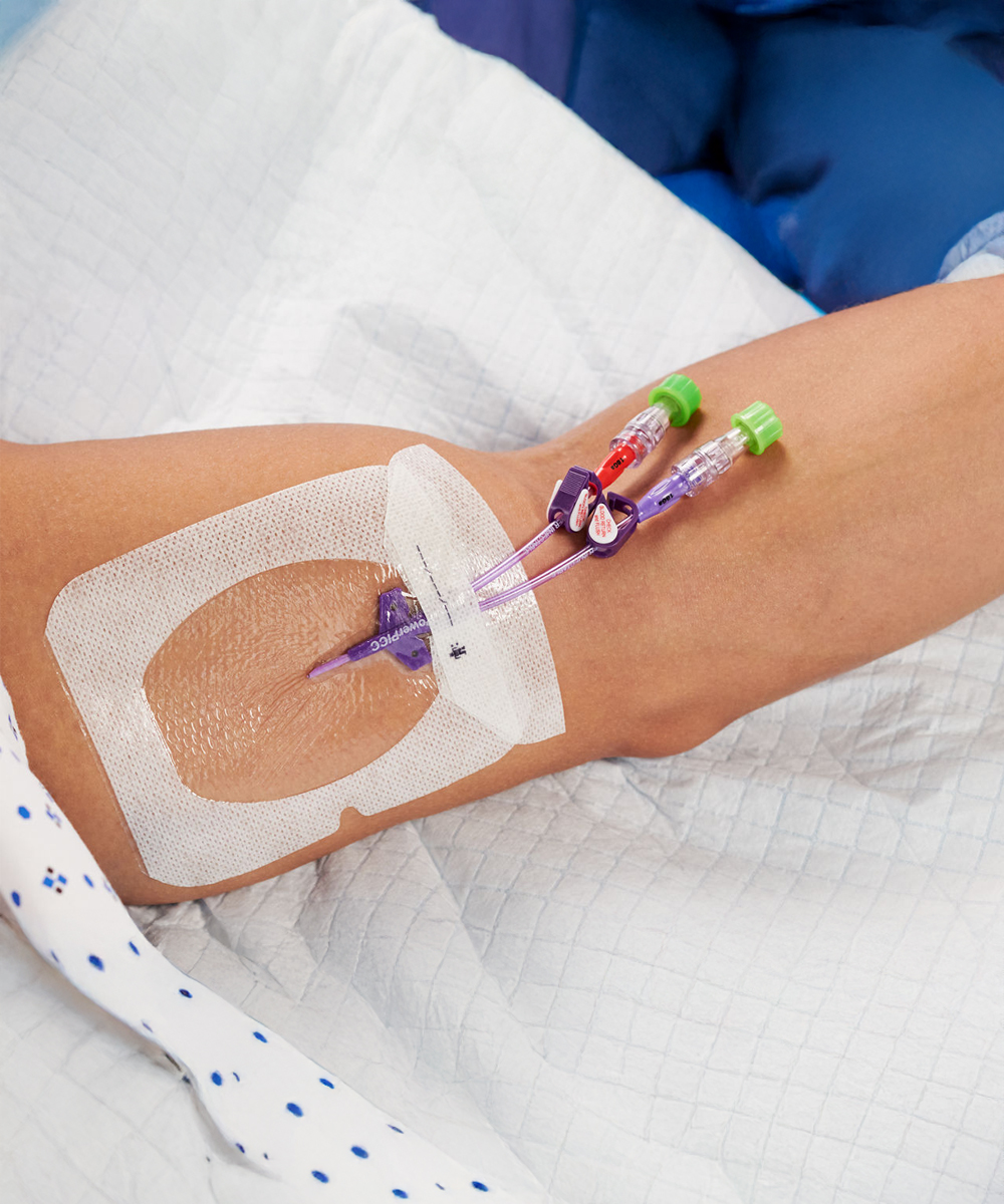 Immagine della medicazione 3M Tegaderm I.V. Advanced con film trasparente, ampia area di fissaggio e sistema adesivo rinforzato per cateteri CVC e PICC.