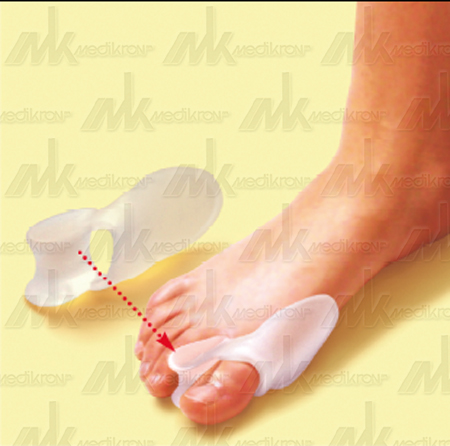 Protezione per alluce valgo con divaricatore, mis. unica 